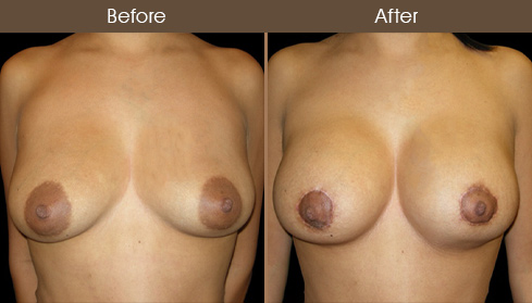 20202705173654_B33-Front